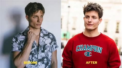 matt rife abs|matt rife before chin implant.